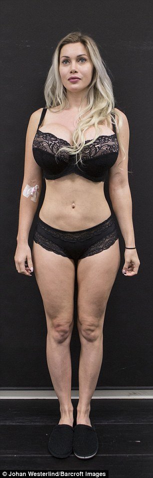 Το μοντέλο που έχει κάνει πάνω από 100 πλαστικές -Εχει αφαιρέσει 6 πλευρά [εικόνες] | iefimerida.gr 6