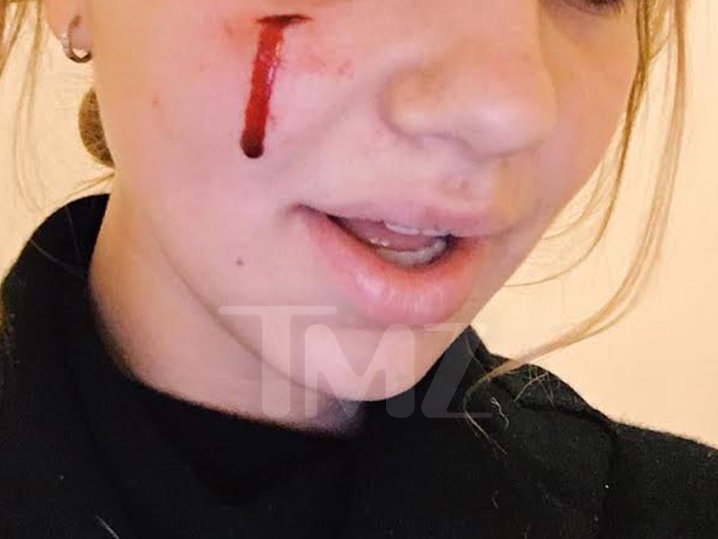 Ο σκύλος των Ομπάμα δάγκωσε στο πρόσωπο 18χρονη [εικόνες] | iefimerida.gr 0