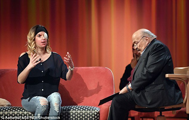 Σοκάρει η Ιταλίδα καλλονή: Μου έριξε οξύ στο πρόσωπο ο σύντροφός μου [εικόνες & βίντεο] | iefimerida.gr 3