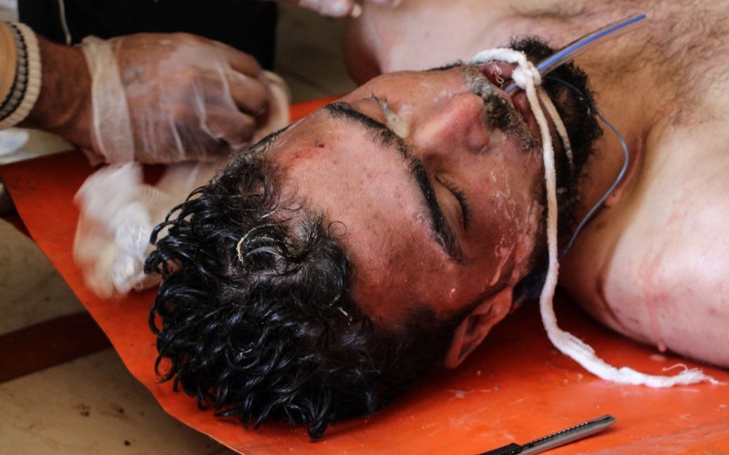 Σοκ στη Συρία: Αεροπορική επιδρομή με τοξικά αέρια -58 νεκροί [εικόνες] | iefimerida.gr 0