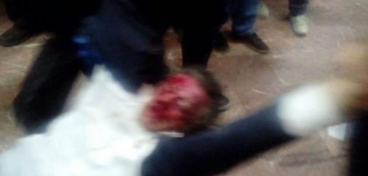 Σκόπια: Αιματηρά επεισόδια άνευ προηγουμένου στη Βουλή, 100 τραυματίες | iefimerida.gr 1