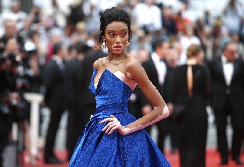 Κάννες: Το μοντέλο με τη λεύκη «αφάνισε» όλες τις προκλητικές καλλονές -Εκπληκτική εμφάνιση [εικόνες] | iefimerida.gr 1