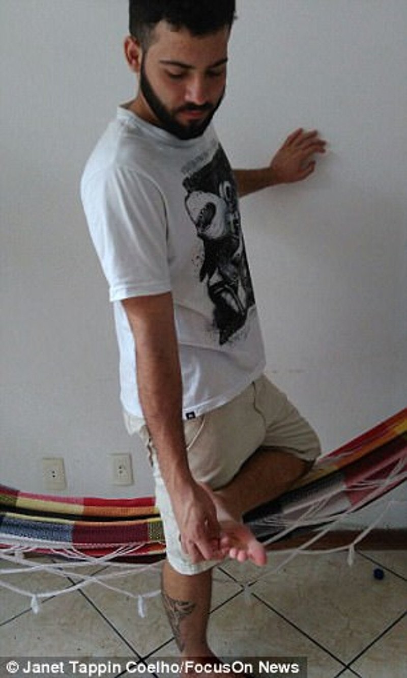 Σοκ στη Βραζιλία: Ενας νεκρός και 40 τραυματίες από επιθέσεις νυχτερίδων βαμπίρ [εικόνες] | iefimerida.gr 3