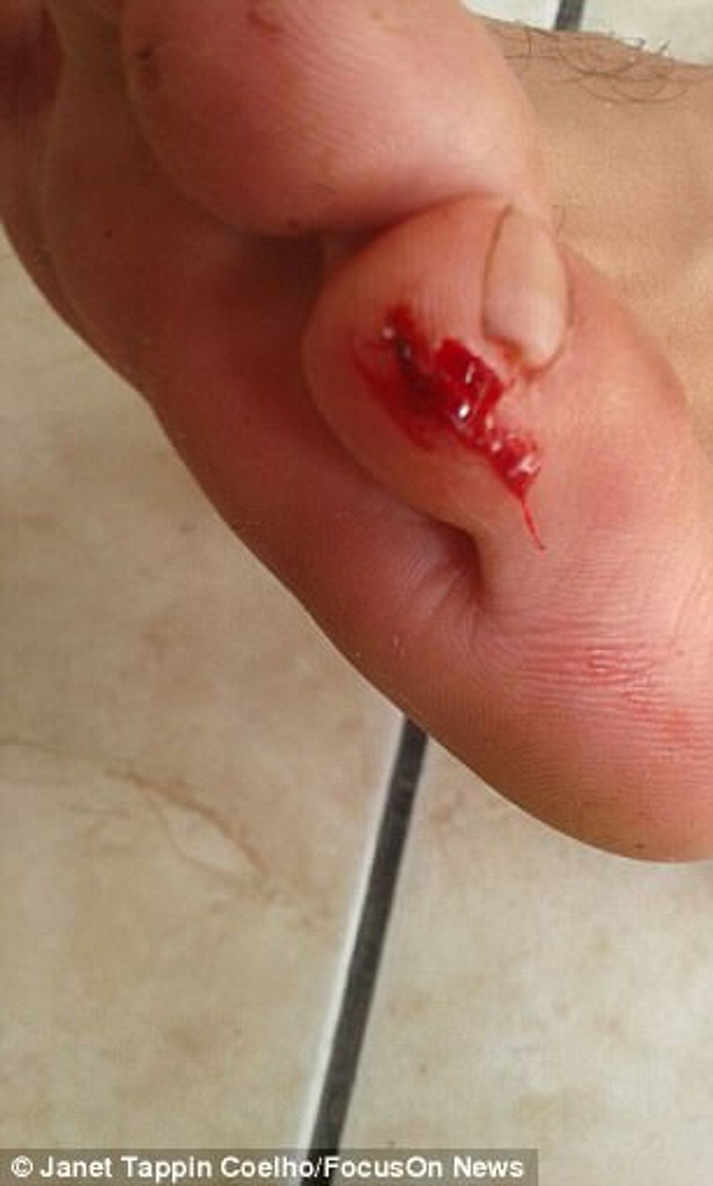 Σοκ στη Βραζιλία: Ενας νεκρός και 40 τραυματίες από επιθέσεις νυχτερίδων βαμπίρ [εικόνες] | iefimerida.gr 4