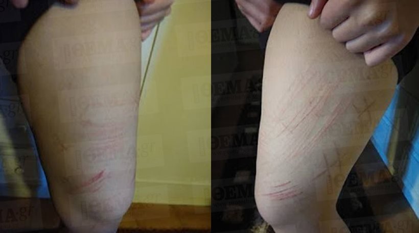 «Μπλε Φάλαινα»: Το πρώτο θύμα του θανατηφόρου διαδικτυακού «παιχνιδιού» στην Ελλάδα [εικόνα] | iefimerida.gr 0