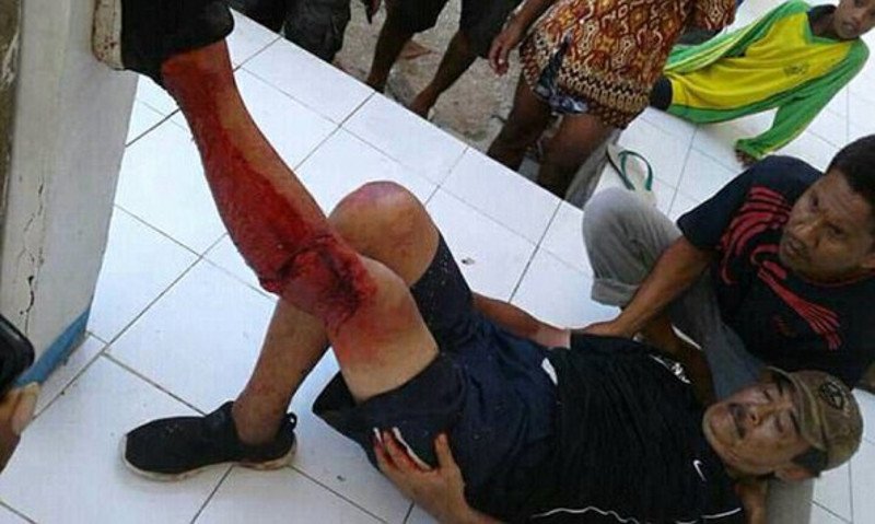 Ινδονησία: Τουρίστας δέχτηκε άγρια επίθεση από τη μεγαλύτερη σαύρα του κόσμου -Τον Δράκο του Κομόντο [εικόνα & βίντεο] | iefimerida.gr 0