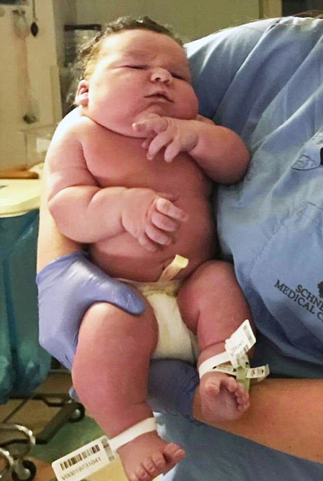 Mωρό-γίγας στην Ιντιάνα: Βάρους 7,5 κιλών και ύψους 62 εκατοστών [εικόνες] | iefimerida.gr 0