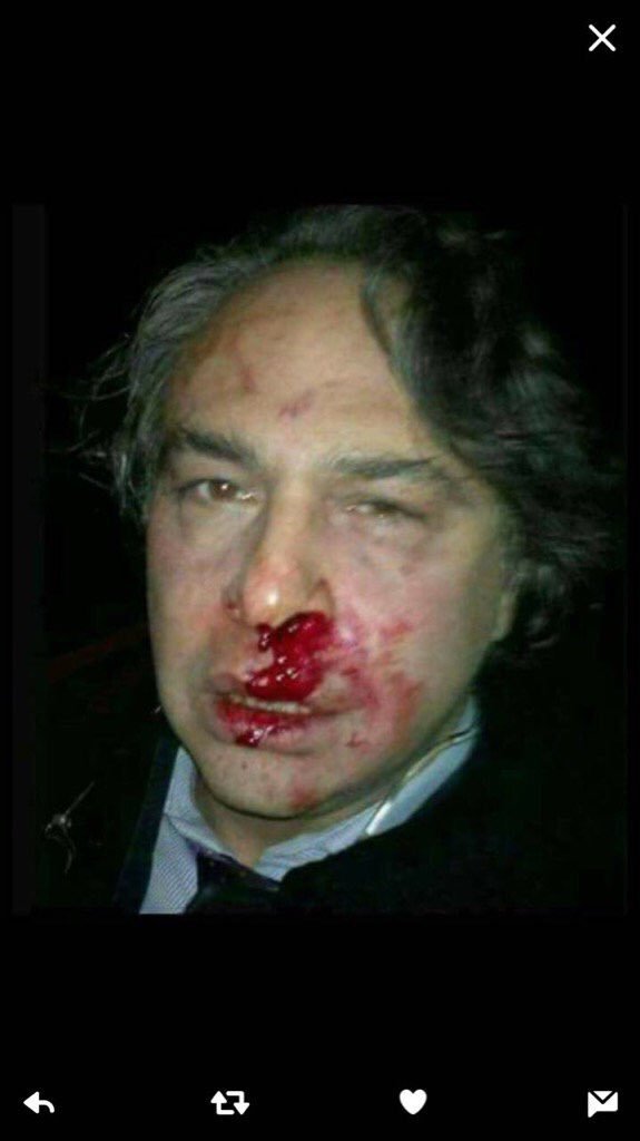 6 μήνες φυλάκιση στον Τούρκο σχεδιαστή που είπε «Πνίξου στο σκατό σου Τουρκία» [βίντεο] | iefimerida.gr 1