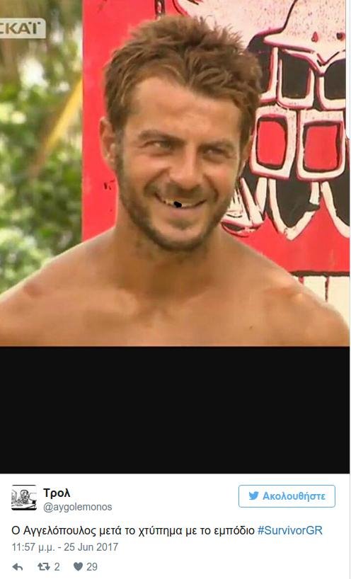 Survivor: Το Τwitter κάνει «πάρτι» για το σπασμένο δόντι του Ντάνου [εικόνες] | iefimerida.gr 2