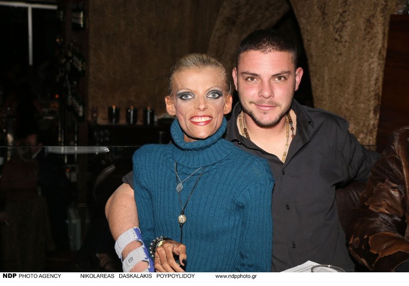 Ποια ήταν η Νανά Καραγιάννη –Η πολύχρονη μάχη με τη νευρική ανορεξία [εικόνες & βίντεο] | iefimerida.gr 1