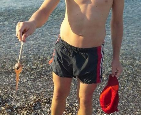 Τσούχτρες παντού στην Πάτρα: Για πρωτόγνωρο φαινόμενο μιλούν οι κάτοικοι [εικόνες] | iefimerida.gr 2