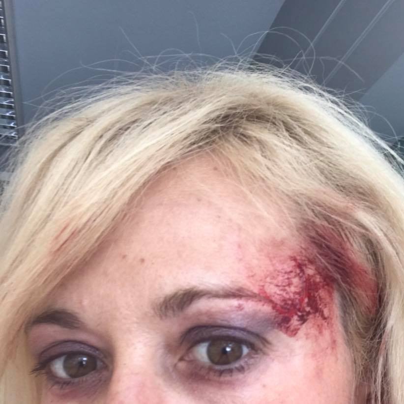 Ξυλοκοπήθηκε γνωστή χορεύτρια μέσα στο αυτοκίνητό της [εικόνες] | iefimerida.gr 1