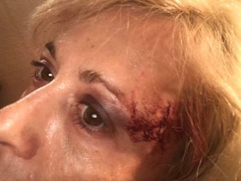 Ξυλοκοπήθηκε γνωστή χορεύτρια μέσα στο αυτοκίνητό της [εικόνες] | iefimerida.gr 0