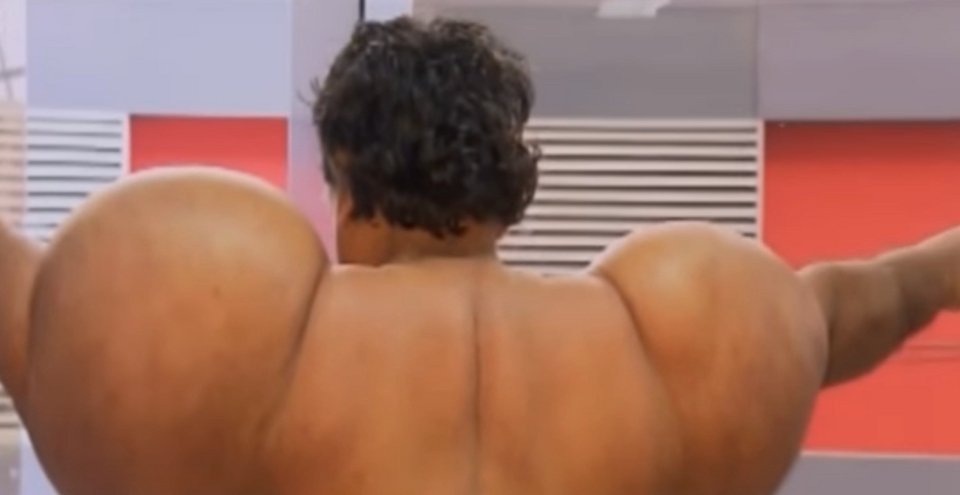 Απίστευτη παραμόρφωση: Ψαράς έπαθε τη νόσο του δύτη και φούσκωσε σαν μπαλόνι [βίντεο] | iefimerida.gr 1