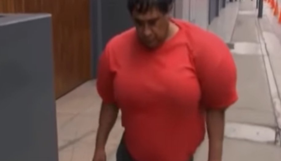 Απίστευτη παραμόρφωση: Ψαράς έπαθε τη νόσο του δύτη και φούσκωσε σαν μπαλόνι [βίντεο] | iefimerida.gr 0