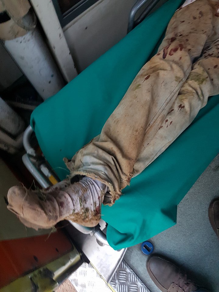 KEEΡΦΑ: Δολοφονική επίθεση χρυσαυγιτών κατά μεταναστών -Τους χτύπησαν με σιδηρογροθιές [σκληρές εικόνες]  | iefimerida.gr 1