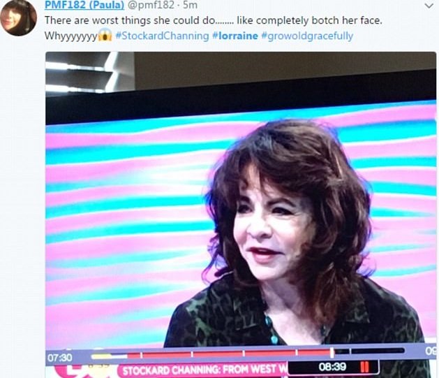 Παραμορφωμένη από τις πλαστικές η πρωταγωνίστρια του Grease- Τα social media την έκαναν... φέτες [εικόνες] | iefimerida.gr 4