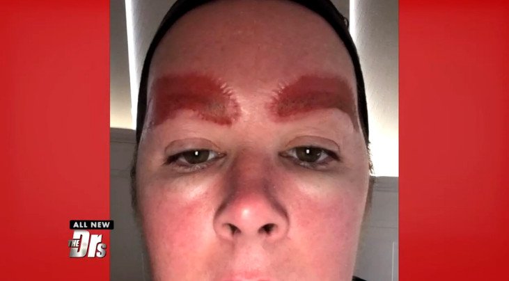 Εικόνες-σοκ: Γυναίκα πήγε να πυκνώσει τα φρύδια και έφυγε με δυο τεράστιες ουλές [εικόνες] | iefimerida.gr 1