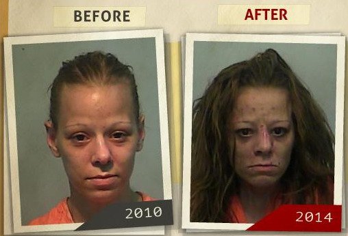 Εικόνες σοκ: Πώς τα ναρκωτικά σκάβουν και αλλάζουν τα πρόσωπα των χρηστών [εικόνες] | iefimerida.gr 0