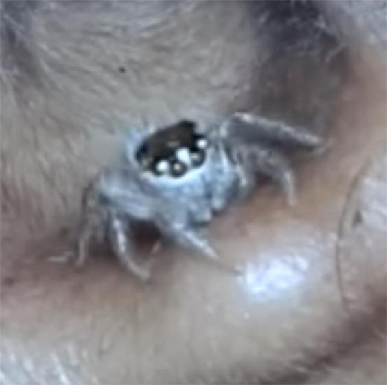 Απίστευτο: Πήγε στον γιατρό με τρομερό πονοκέφαλο και της βρήκαν... αράχνη στο αυτί [εικόνες & βίντεο] | iefimerida.gr 0