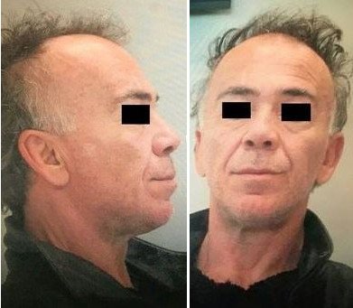 Αυτός είναι ο δολοφόνος της Δώρας Ζέμπερη [εικόνες] | iefimerida.gr 0