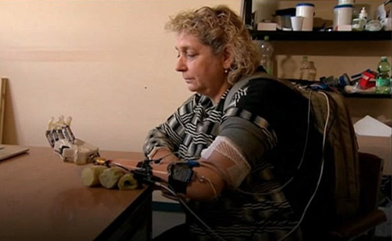 Δημιουργήθηκε το πρώτο βιονικό χέρι με αίσθηση αφής [εικόνες] | iefimerida.gr 1