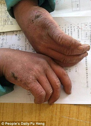 «Το παιδί με τα παγωμένα μαλλιά»: Μαθητής περπατά επί μία ώρα κάθε μέρα στους -9 για να πάει σχολείο [εικόνες] | iefimerida.gr 2