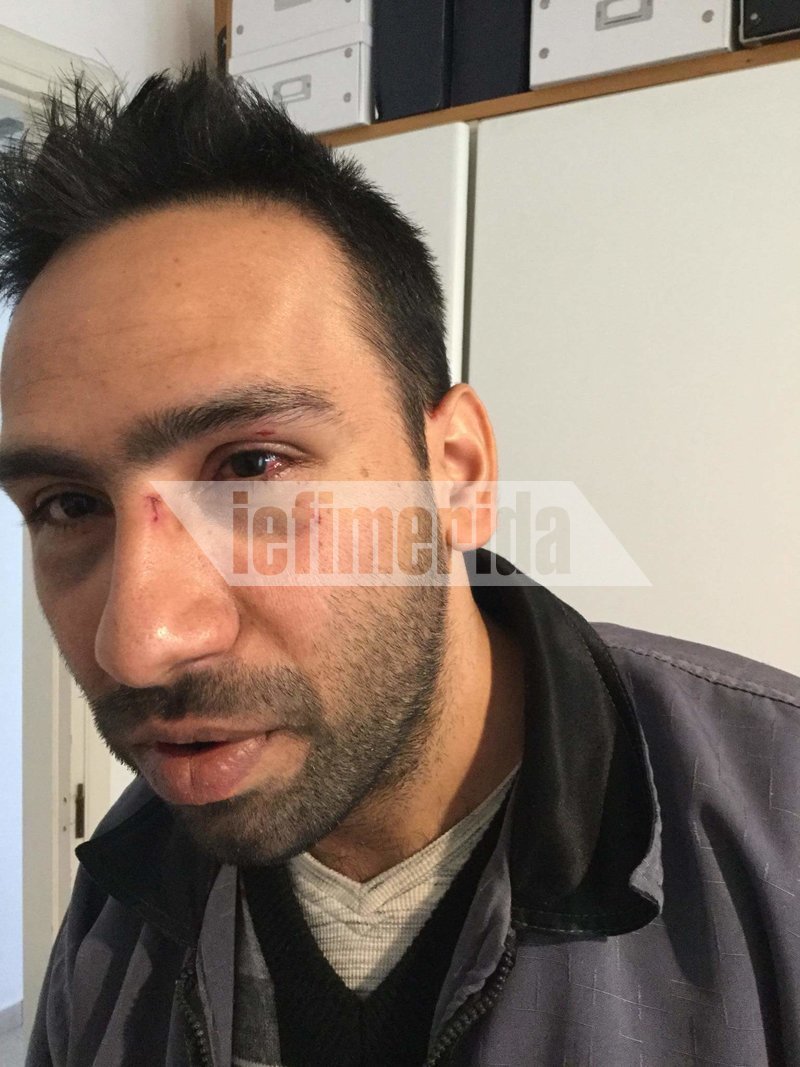  Τρόμος στου Φιλοπάππου -Ομάδα Ρομά επιτέθηκε, ξυλοκόπησε και λήστεψε παρέα [εικόνες] | iefimerida.gr 0