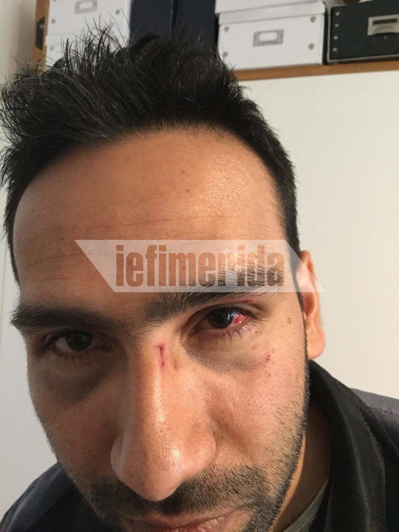  Τρόμος στου Φιλοπάππου -Ομάδα Ρομά επιτέθηκε, ξυλοκόπησε και λήστεψε παρέα [εικόνες] | iefimerida.gr 1