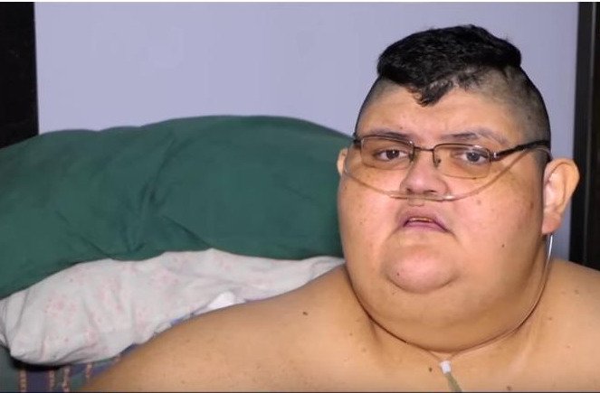 Ο πιο χοντρός άνθρωπος στον κόσμο ζυγίζει 527 κιλά [εικόνες] | iefimerida.gr 0