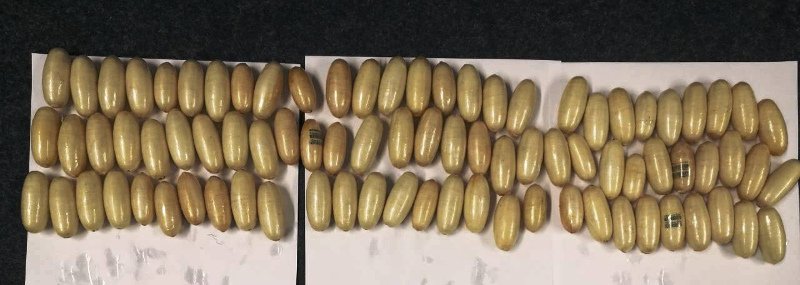 Βραζιλιάνος κατάπιε 1,1 κ. κοκαΐνη -Για να περάσει τα ναρκωτικά από το «Ελ. Βενιζέλος» [εικόνες] | iefimerida.gr 1