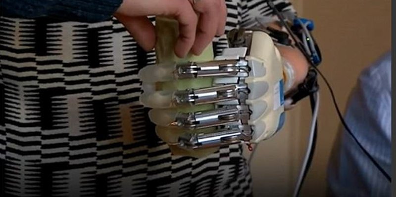 Δημιουργήθηκε το πρώτο βιονικό χέρι με αίσθηση αφής [εικόνες] | iefimerida.gr 2