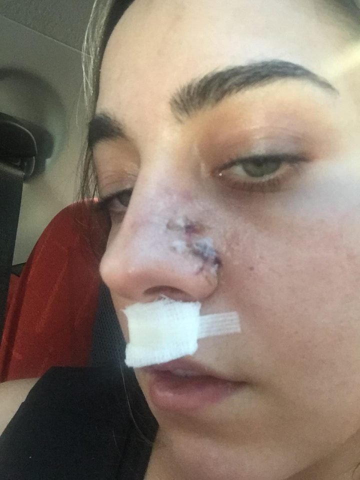 Πορνοστάρ διέκοψε «περιοδεία στοματικού έρωτα» στην Ιταλία γιατί τη δάγκωσε σκύλος [εικόνες]   | iefimerida.gr 1