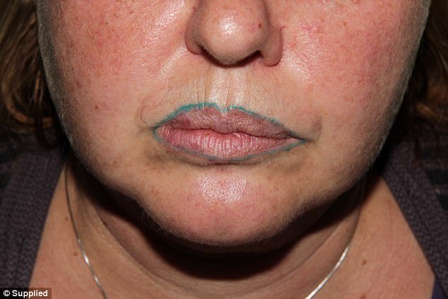 Ταξίδεψε από την Αυστραλία έως την Ταϊτή για να κάνει τατουάζ στα χείλη της- Το αποτέλεσμα ήταν για γέλια [εικόνες] | iefimerida.gr 1