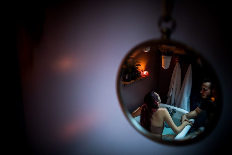  15 ανεπανάληπτες, ωμές, φωτογραφίες για τον τοκετό και τη μητρότητα [εικόνες] | iefimerida.gr 8