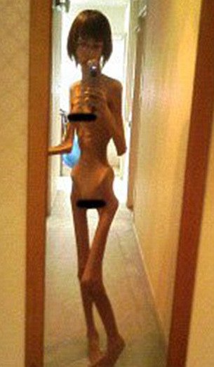 Ανατριχιαστικό: Αυτή η Γιαπωνέζα ζυγίζει μόνο 17 κιλά [εικόνες]  | iefimerida.gr 5