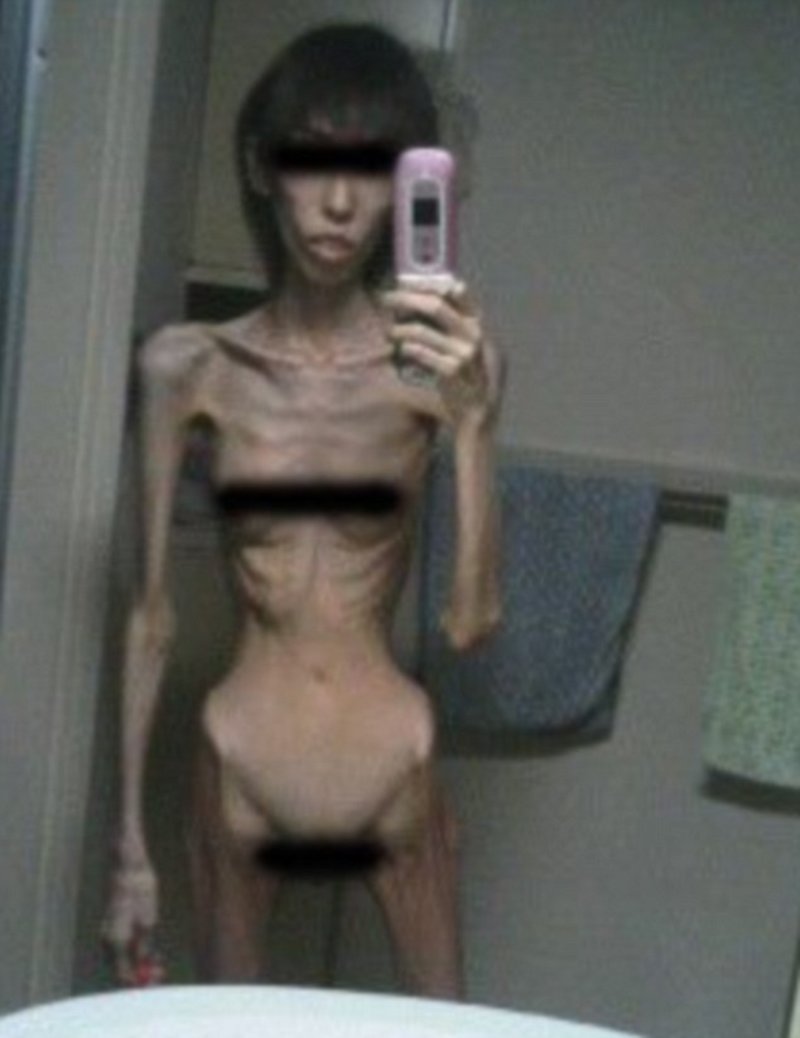 Ανατριχιαστικό: Αυτή η Γιαπωνέζα ζυγίζει μόνο 17 κιλά [εικόνες]  | iefimerida.gr 1