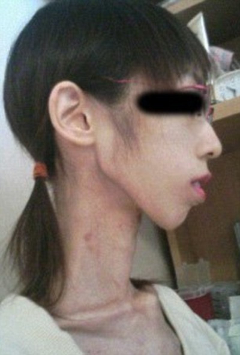 Ανατριχιαστικό: Αυτή η Γιαπωνέζα ζυγίζει μόνο 17 κιλά [εικόνες]  | iefimerida.gr 4