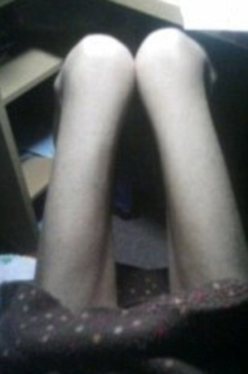 Ανατριχιαστικό: Αυτή η Γιαπωνέζα ζυγίζει μόνο 17 κιλά [εικόνες]  | iefimerida.gr 2