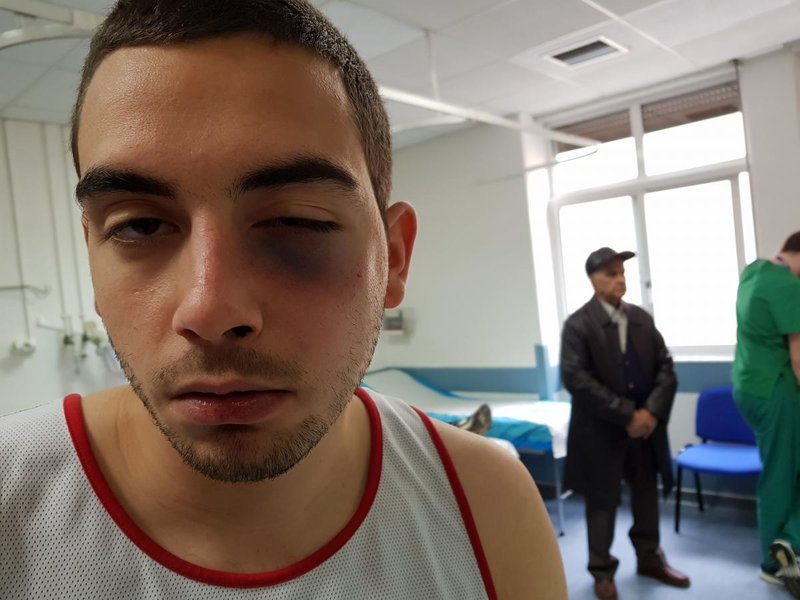 Γυμναστής «έσπασε» στο ξύλο 21χρονο σε γυμναστήριο του Αλίμου επειδή διαφώνησαν για μία άσκηση | iefimerida.gr 0