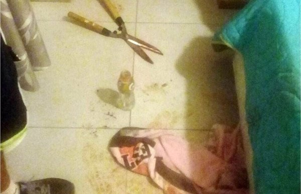 26χρονη «κλάδεψε» με ψαλίδι κήπου το μόριο του εραστή της επειδή έδειξε ένα sex tape τους σε φίλους του | iefimerida.gr 0