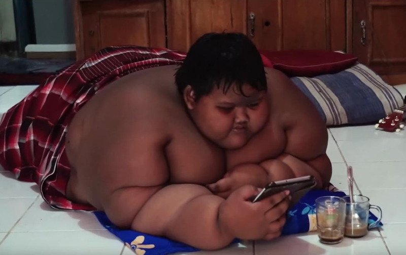 Το πιο χοντρό παιδί του κόσμου (180 κιλά) έχασε 90 κιλά [εικόνες]