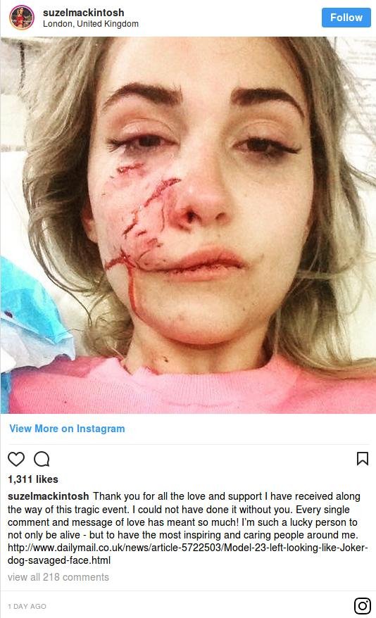 Φρίκη στην Αυστραλία: Μοντέλο πήγε να χαϊδέψει σκύλο κι εκείνος της κομμάτιασε το πρόσωπο [εικόνες]  | iefimerida.gr 1