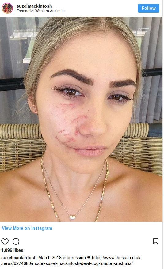 Φρίκη στην Αυστραλία: Μοντέλο πήγε να χαϊδέψει σκύλο κι εκείνος της κομμάτιασε το πρόσωπο [εικόνες]  | iefimerida.gr 2