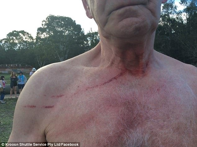 Καγκουρό επιτίθενται με κλωτσιές σε τουρίστες στην Αυστραλία [εικόνες] | iefimerida.gr 2