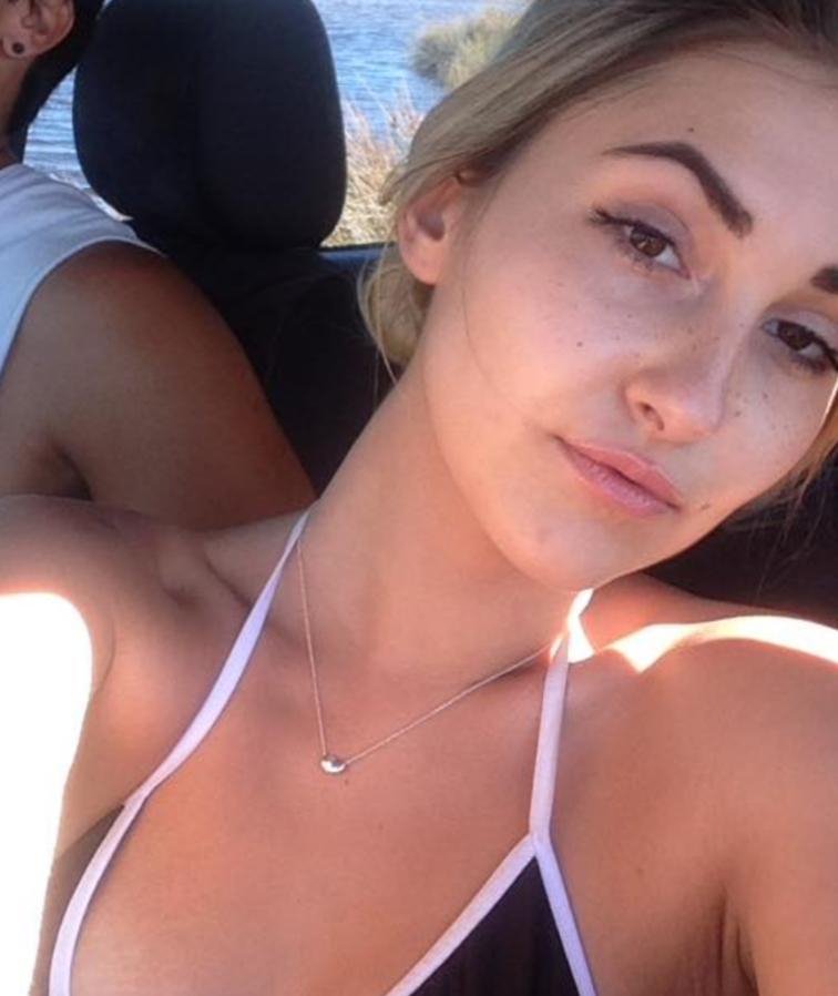 Φρίκη στην Αυστραλία: Μοντέλο πήγε να χαϊδέψει σκύλο κι εκείνος της κομμάτιασε το πρόσωπο [εικόνες]  | iefimerida.gr 0