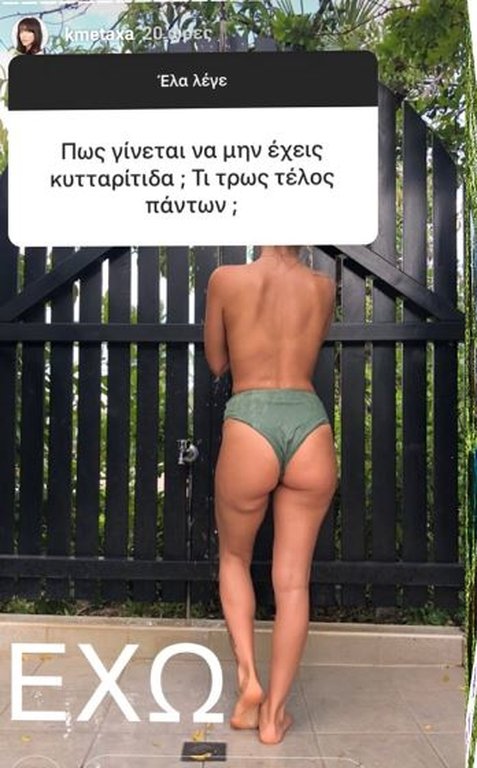 «Εχω κυτταρίτιδα» λέει η Κόνι Μεταξά και ποστάρει και φωτό [εικόνα] | iefimerida.gr 0