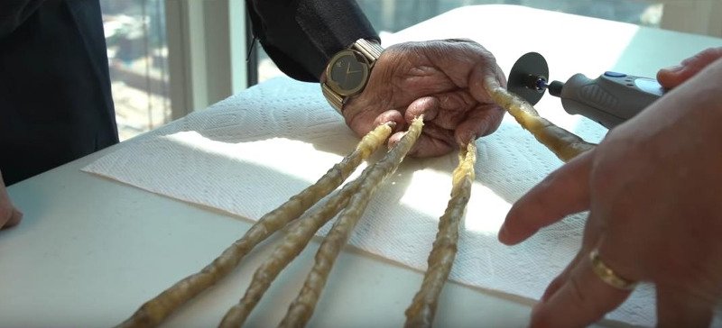 Ο άνδρας με τα μακρύτερα νύχια αποφάσισε να τα κόψει μετά από 66 χρόνια – Είχαν μήκος 8,8 μέτρα [βίντεο]  | iefimerida.gr 0