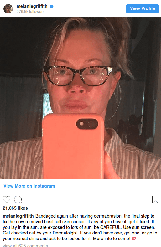 Συγκλονίζει η αγνώριστη Μέλανι Γκρίφιθ μετά από ακόμη ένα χειρουργείο στο πρόσωπο [εικόνες] | iefimerida.gr 2