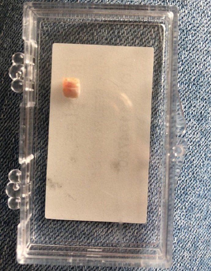 Αφωνος οδοντίατρος στη Βρετανία -Του πήγαν 12 ημερών μωρό για... εξαγωγή δοντιού [εικόνες] | iefimerida.gr 1